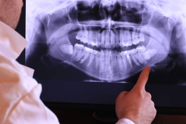 Best Emergency Dental Extractions in Vincent, CA